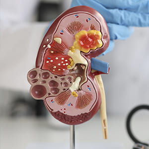 biopsias
